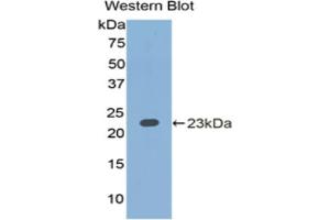 Western blot analysis of the recombinant protein. (IL1A antibody  (AA 90-268))