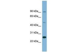 Image no. 1 for anti-Leucine Rich Repeat Containing 49 (LRRC49) (AA 35-84) antibody (ABIN6742052) (LRRC49 antibody  (AA 35-84))