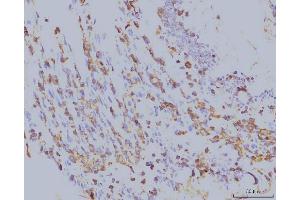 IHC analysis of EIF4A1 using anti-EIF4A1 antibody (ABIN7603144). (EIF4A1 antibody  (N-Term))