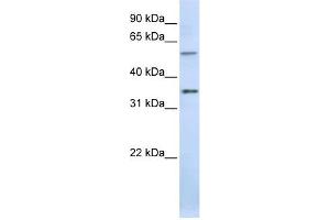 TJAP1 antibody used at 1 ug/ml to detect target protein.