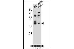 Western blot analysis in MDA-MB453,HL-60 cell line lysates (35ug/lane). (SOX3 antibody  (AA 166-196))