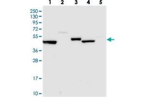 Western blot analysis of Lane 1: RT-4, Lane 2: U-251 MG, Lane 3: Human Plasma, Lane 4: Liver, Lane 5: Tonsil with UAP1L1 polyclonal antibody  at 1:250-1:500 dilution. (UAP1L1 antibody)