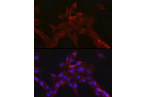 Immunofluorescence analysis of PC-12 cells using nNOS Rabbit mAb (ABIN1680436, ABIN1680435, ABIN7101483 and ABIN7101484) at dilution of 1:100 (40x lens). (NOS1 antibody)