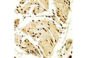 Immunohistochemistry of paraffin-embedded Human esophageal using NFATC1 antibody at dilution of 1:100 (x400 lens). (NFATC1 antibody  (AA 20-300))