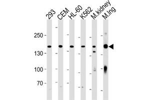 Western Blotting (WB) image for anti-Plakophilin 4 (PKP4) antibody (ABIN3004661) (Plakophilin 4 antibody)