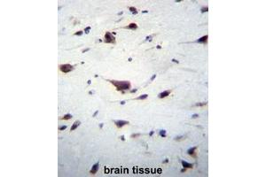 Immunohistochemistry (Paraffin-embedded Sections) (IHC (p)) image for anti-Phosphatidylinositol-3,4,5-Trisphosphate-Dependent Rac Exchange Factor 1 (PREX1) (AA 1133-1163), (C-Term) antibody (ABIN954297)