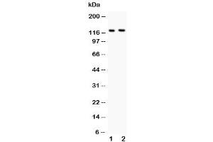 Western blot testing of BOC antibody and Lane 1:  mouse brain (BOC antibody  (AA 1002-1020))