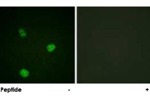 Immunofluorescence analysis of HeLa cells, using MITF polyclonal antibody . (MITF antibody  (Ser73, Ser180))
