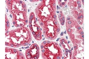 Human Kidney (formalin-fixed, paraffin-embedded) stained with CPT1A antibody at 4 µg/ml followed by biotinylated anti-goat IgG secondary antibody, alkaline phosphatase-streptavidin and chromogen. (CPT1A antibody  (Internal Region))