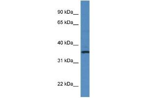 WB Suggested Anti-RIOK1 Antibody Titration: 1. (RIOK1 antibody  (C-Term))