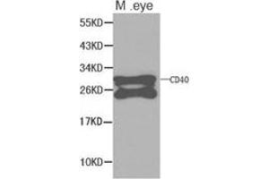 Western Blotting (WB) image for anti-CD40 (CD40) antibody (ABIN1871634) (CD40 antibody)