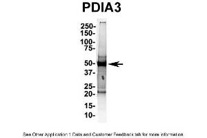 IP Suggested AntiPDIA3 Antibody Positive Control: NT2 CELL/BRAIN TISSUE (PDIA3 antibody  (C-Term))
