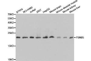 Western blot analysis of extracts of various cell lines, using PSMB5 antibody. (PSMB5 antibody  (AA 1-263))