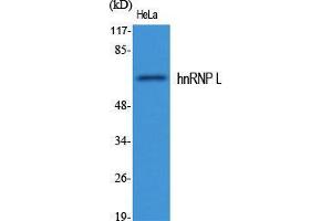 Western Blot (WB) analysis of specific cells using hnRNP L Polyclonal Antibody. (HNRNPL antibody  (Internal Region))