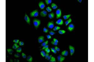 Immunofluorescence staining of Hela cells with ABIN7158207 at 1:166, counter-stained with DAPI. (LRIG2 antibody  (AA 833-932))
