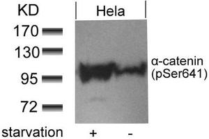 Western blot analysis of extracts from Hela cells untreated or treated with starvation using a-catenin(Phospho-Ser641) antibody. (CTNNA1 antibody  (pSer641))