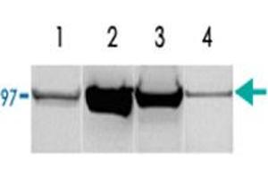 (1) Rat liver homogenate (50 ug of total protein). (PYGM antibody)