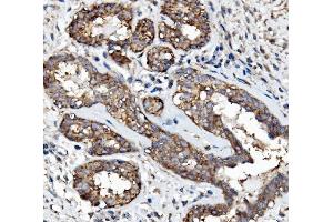 IHC analysis of EGFR using anti-EGFR antibody (ABIN7601478). (EGFR antibody  (AA 36-497))