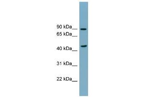 WB Suggested Anti-SMPD2 Antibody Titration:  0.