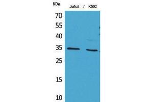 Western Blot (WB) analysis of Jurkat, K562 cells using Acetyl-Ref-1 (K7) Polyclonal Antibody. (APEX1 antibody  (acLys7))