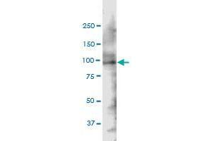 SH3KBP1 monoclonal antibody (M01), clone 1F11. (SH3KBP1 antibody  (AA 224-308))