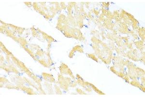 Immunohistochemistry of paraffin-embedded Rat heart using UQCC2 Polyclonal Antibody at dilution of 1:100 (40x lens). (MNF1 antibody)