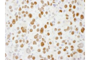 Immunohistochemistry (IHC) image for anti-Sp1 Transcription Factor (SP1) (AA 735-785) antibody (ABIN7453450) (SP1 antibody  (AA 735-785))