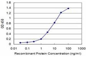 Detection limit for recombinant GST tagged HOXB7 is approximately 0. (HOXB7 antibody  (AA 55-120))