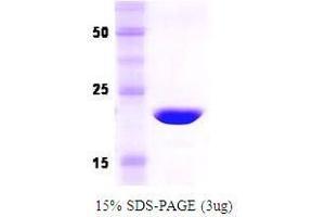 Figure annotation denotes ug of protein loaded and % gel used. (Recoverin Protein (RCVRN))