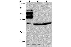 Western blot analysis of Human rectal cancer tissue, Jurkat and HT-29 cell, using PCSK9 Polyclonal Antibody at dilution of 1:200 (PCSK9 antibody)