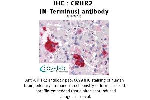 Image no. 1 for anti-Corticotropin Releasing Hormone Receptor 2 (CRHR2) (Extracellular Domain), (N-Term) antibody (ABIN1733312) (CRHR2 antibody  (Extracellular Domain, N-Term))