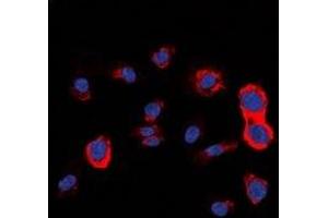 Immunofluorescent analysis of HER2 staining in HepG2 cells. (ErbB2/Her2 antibody)