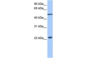 Western Blotting (WB) image for anti-Protein Inhibitor of Activated STAT, 2 (PIAS2) antibody (ABIN2463619) (PIAS2 antibody)