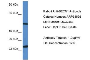 WB Suggested Anti-BECN1 Antibody Titration: 0. (Beclin 1 antibody  (N-Term))