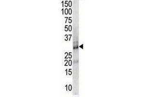 DSCR1 antibody used in western blot to detect DSCR1 in endothelial cell lysate (RCAN1 antibody  (AA 75-104))