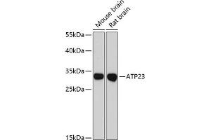 Western blot analysis of extracts of various cell lines, using  antibody (ABIN6127790, ABIN6137312, ABIN6137313 and ABIN6216681) at 1:3000 dilution. (XRCC6BP1 antibody  (AA 1-246))