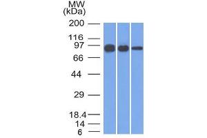 Western Blot of A431, A549 and MCF-7 cell lysates using Catenin, beta Mouse Monoclonal Antibody (12F7) (CTNNB1 antibody  (N-Term))