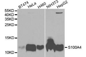 Western blot analysis of extracts of various cell lines, using S100A4 antibody. (s100a4 antibody  (AA 1-101))