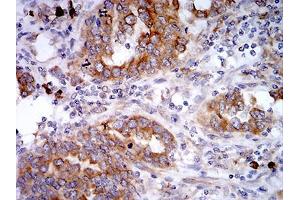 Immunohistochemistry (IHC) image for anti-Selenoprotein S (SELS) (AA 1-187) antibody (ABIN5542694)
