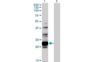 Western Blot analysis of NOL6 expression in transfected 293T cell line by NOL6 MaxPab polyclonal antibody. (Nucleolar Protein 6 antibody  (AA 1-200))