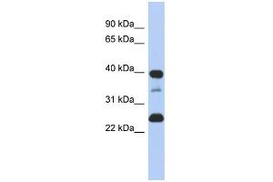 WB Suggested Anti-TMPO Antibody Titration:  0. (Thymopoietin antibody  (N-Term))