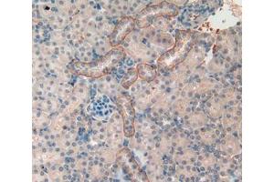Used in DAB staining on fromalin fixed paraffin- embedded kidney tissue (PITRM1 antibody  (AA 653-926))