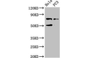 Western Blot Positive WB detected in: Hela whole cell lysate, PC-3 whole cell lysate All lanes: GLB1 antibody at 4 μg/mL Secondary Goat polyclonal to rabbit IgG at 1/50000 dilution Predicted band size: 77, 61, 73 kDa Observed band size: 77 kDa (GLB1 antibody  (AA 317-455))