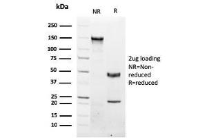 SDS-PAGE Analysis Purified NKX3. (NKX3-1 antibody  (AA 92-224))