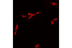 ABIN6268765 staining Hela by IF/ICC. (SOX6 antibody  (N-Term))