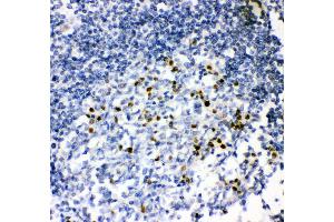 Anti- MUM1 antibody, IHC(P) IHC(P): Human Tonsil Tissue (IRF4 antibody  (AA 272-451))