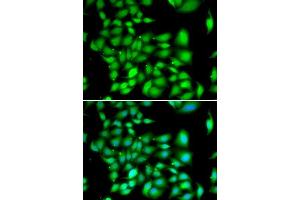 Immunofluorescence analysis of A549 cells using TREX1 antibody. (TREX1 antibody  (AA 1-270))