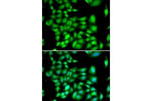 Immunofluorescence analysis of A549 cells using TREX1 antibody.