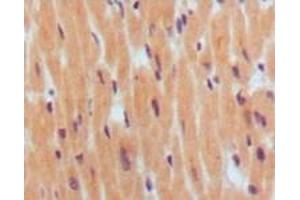 Immunohistochemistry (IHC) image for anti-Brain Natriuretic Peptide (BNP) antibody (ABIN2464019) (BNP antibody)