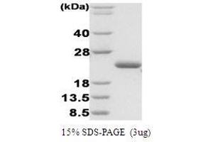 Figure annotation denotes ug of protein loaded and % gel used. (ASPSCR1 Protein)